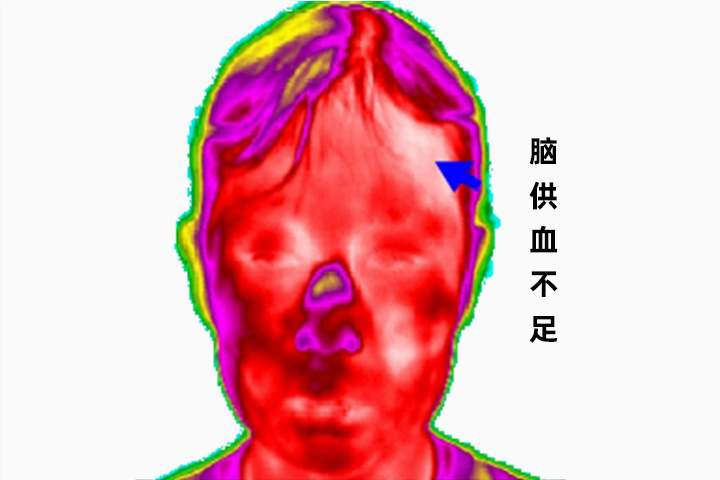红外热成像技术在健康领域的发展和应用